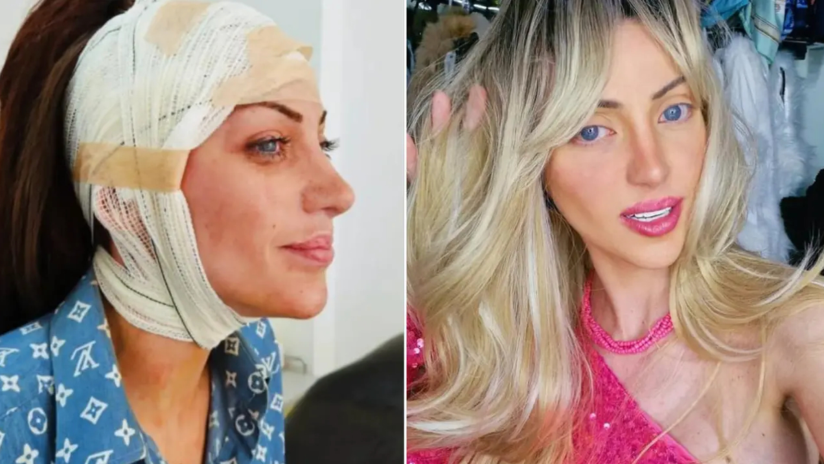 barbie bebege benzemek icin 27 kez ameliyat oldu brezilyali fenomen 31 yasinda hayatini kaybetti uPPYpfSq.jpg
